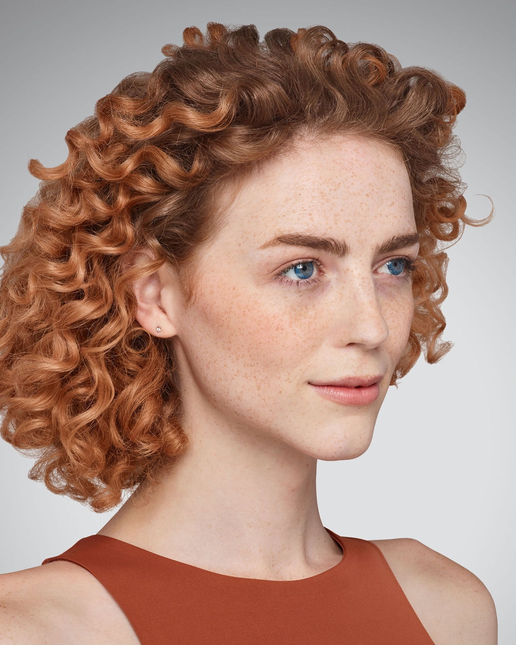 ADDIESON - cheeks, chin, undereye & lips Before Juvederm