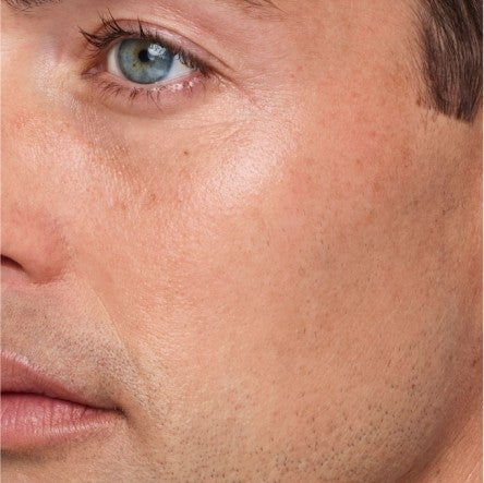 Close up of model's cheeks. 