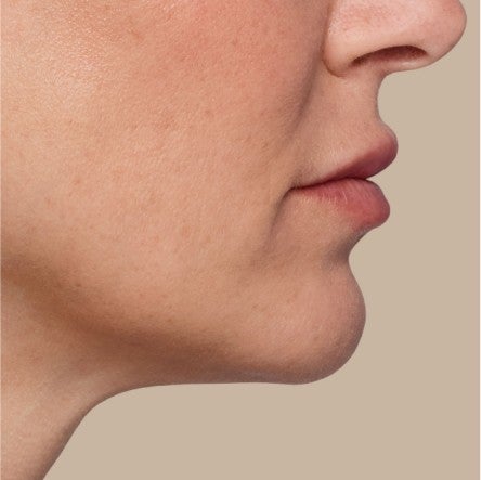 Close up of model's chin. 