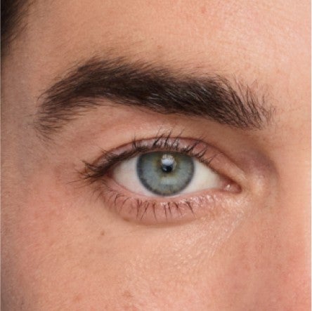 Close up of model's undereye area. 