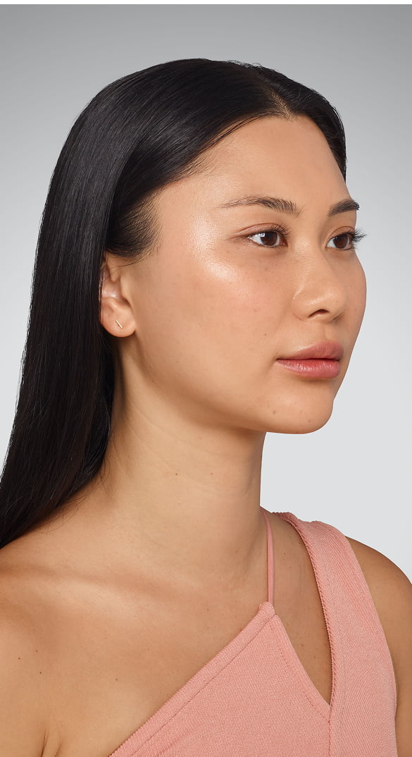 SARA - cheeks, undereye, lips & jawline After Juvederm