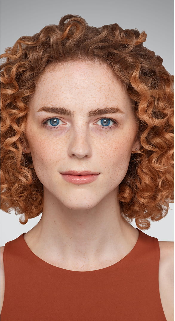 Chin - Before Juvederm